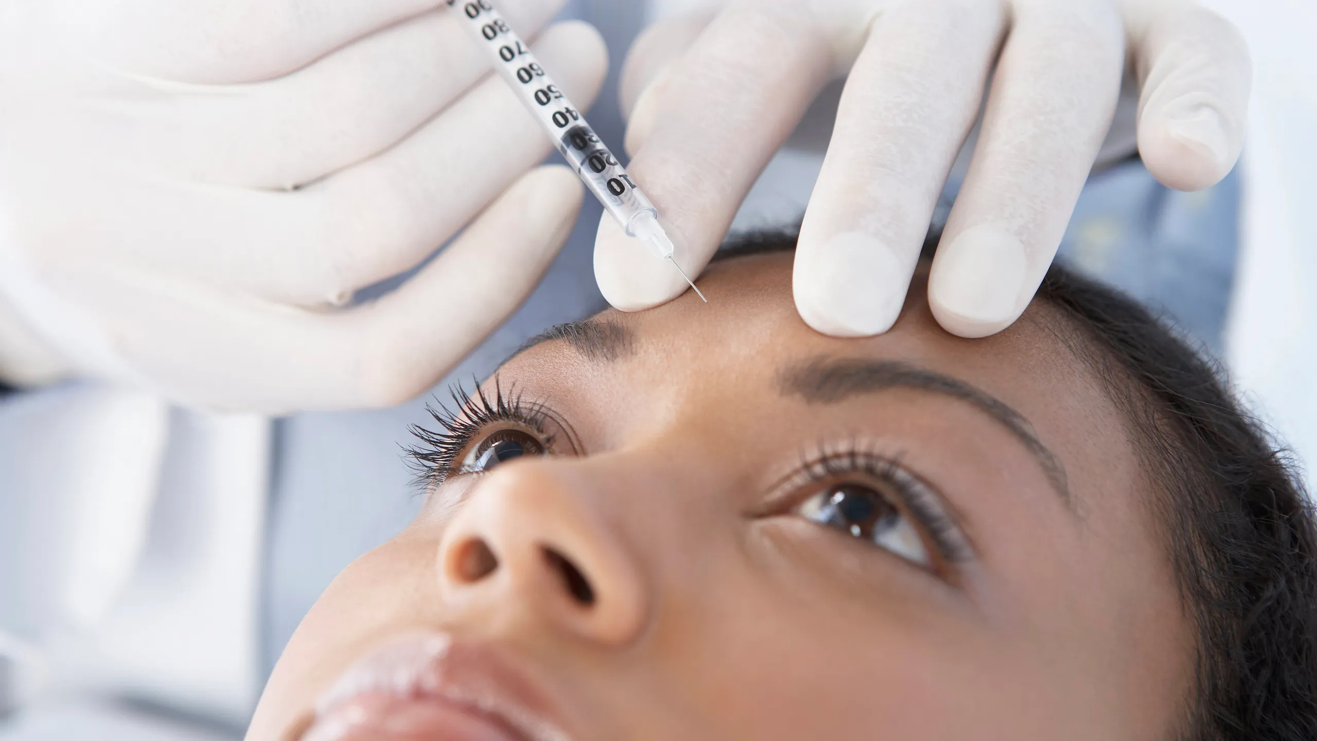 Lazerle cilt bakımı yapılan bölge güneşten korunmalı mıdır?