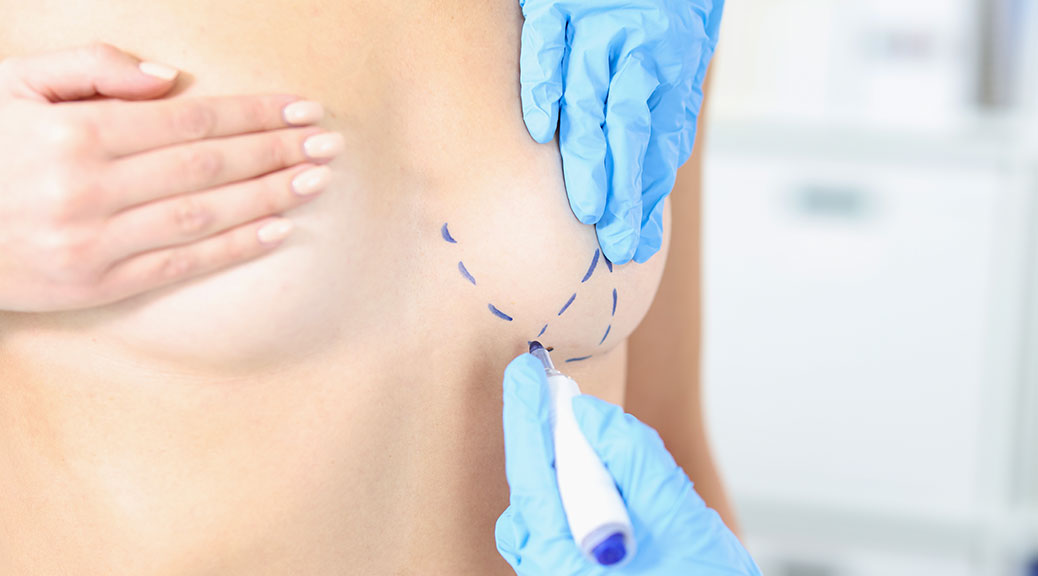 Meme Büyütme Sonrasında Emzirme Döneminde Problem Yaşanır mı?