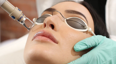 Cilt Lekelerinin Tedavisi