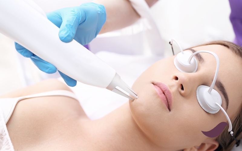 Lazerle cilt bakımı adayları nasıl belirlenir?